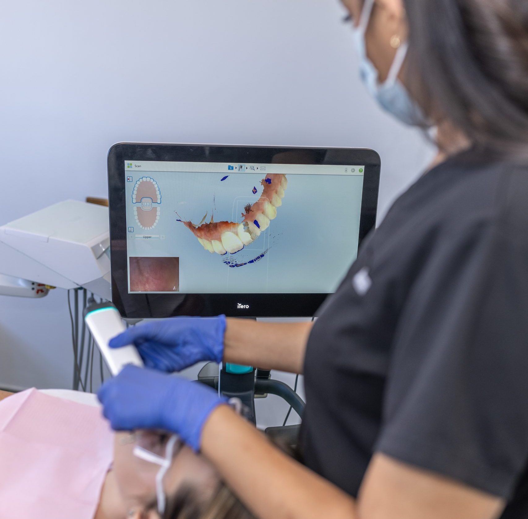 Invisalign Clear Aligners