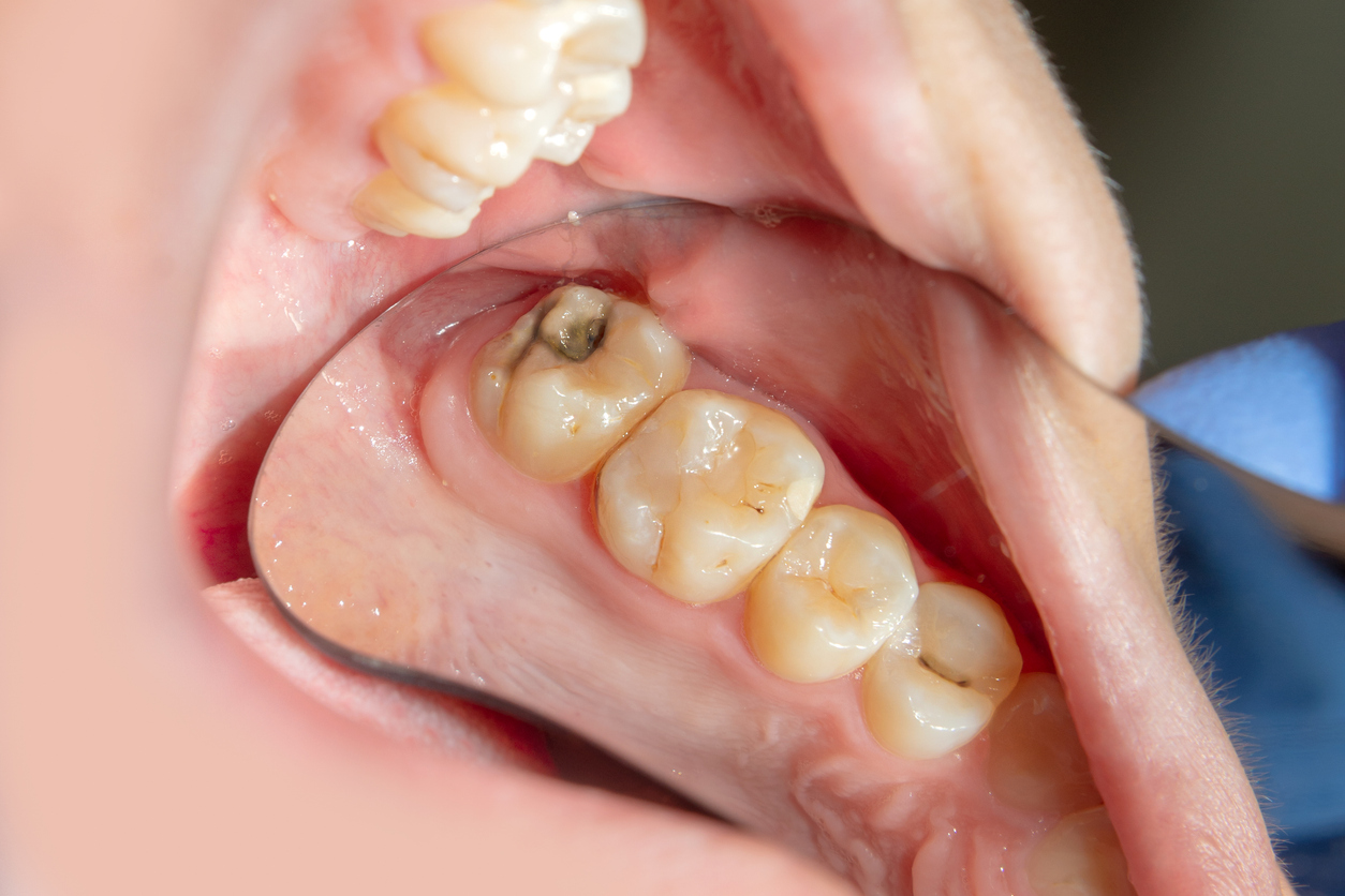 General Dentistry