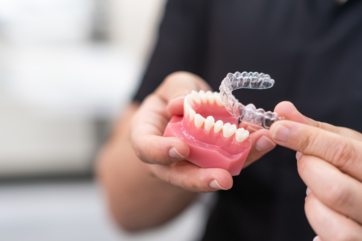Invisalign Clear Aligners