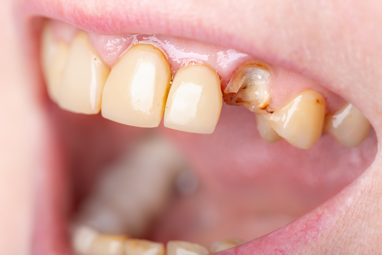 General Dentistry