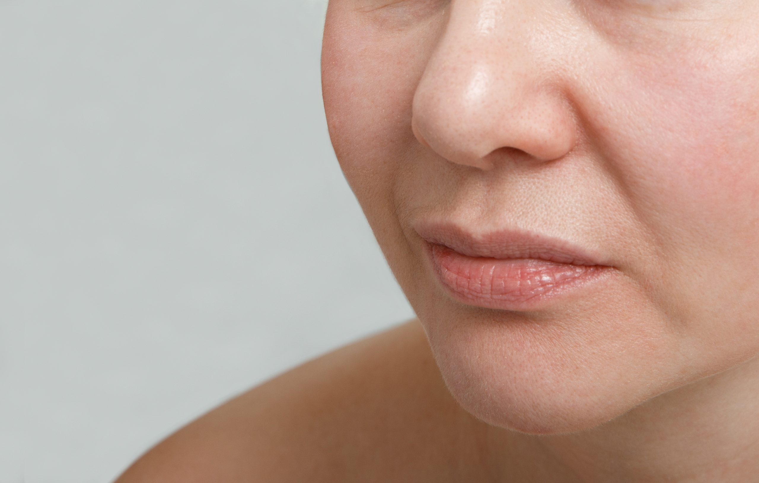 Dermal Fillers