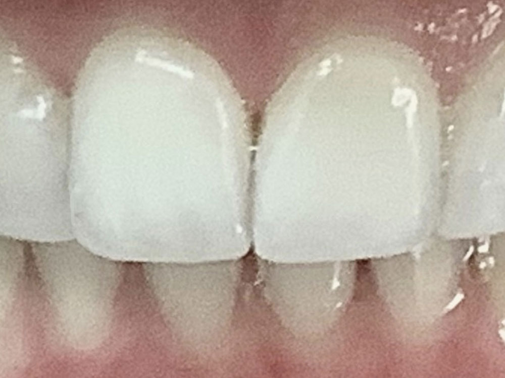 After