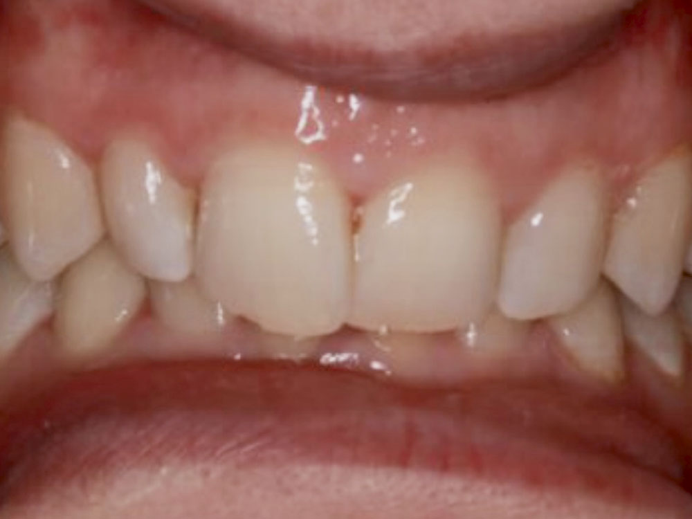 Before