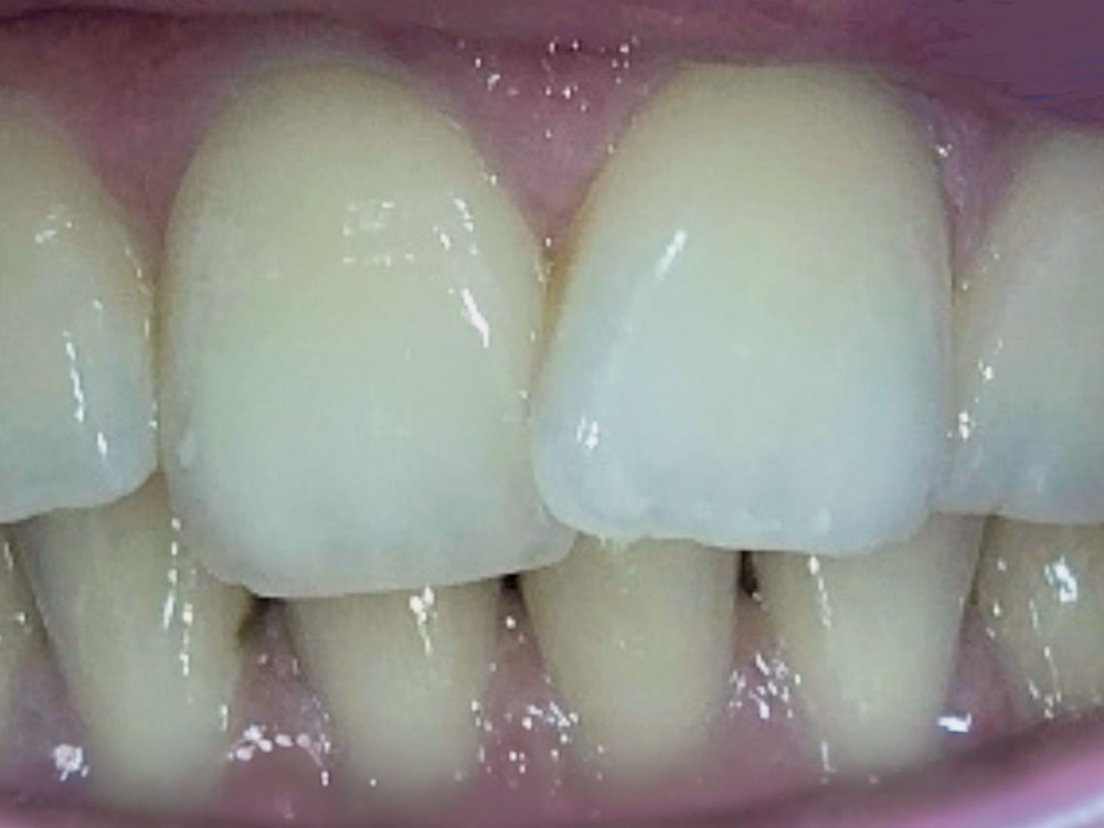 Before